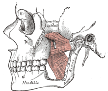 左侧翼内侧肌及其上方的左侧翼外侧肌，显示在下颌支的内侧表面，与颧弓的一部分一起被部分切除